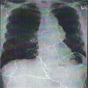 Lung Matter - First Demo Album