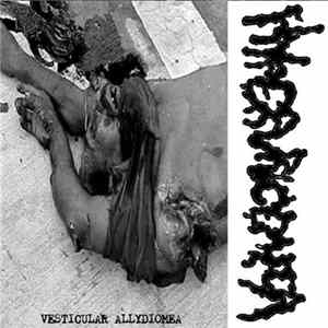 Hyperuricemia - Vesticular Allydiomea Album
