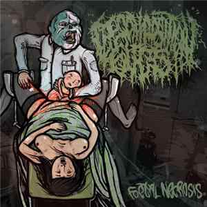 Decomposition Guts - Foetal Necrosis Album